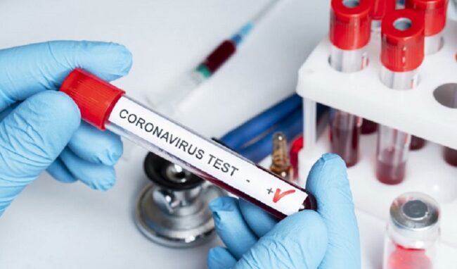 Coronavirus, boom di contagi: 185 nuovi positivi in provincia di Siracusa. In Sicilia 1.739