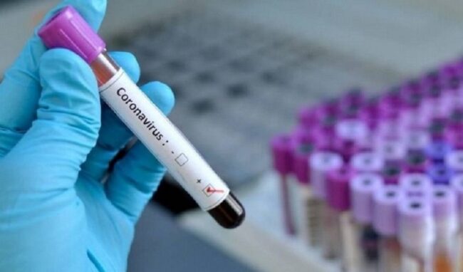 Coronavirus, 39 nuovi positivi in provincia di Siracusa. In Sicilia 505