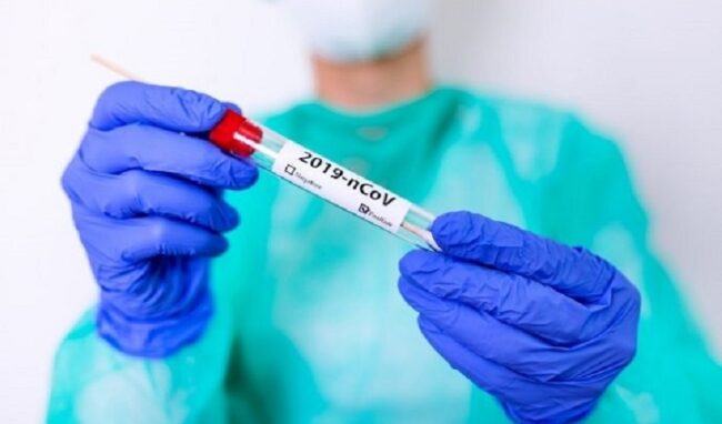 Coronavirus, 90 nuovi positivi in provincia di Siracusa. In Sicilia 414