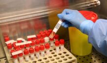 Individuati i laboratori di riferimento per i test Hantavirus 1 laboratori